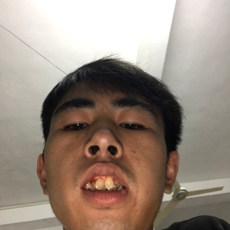 小鸭子爱恋害羞的照片