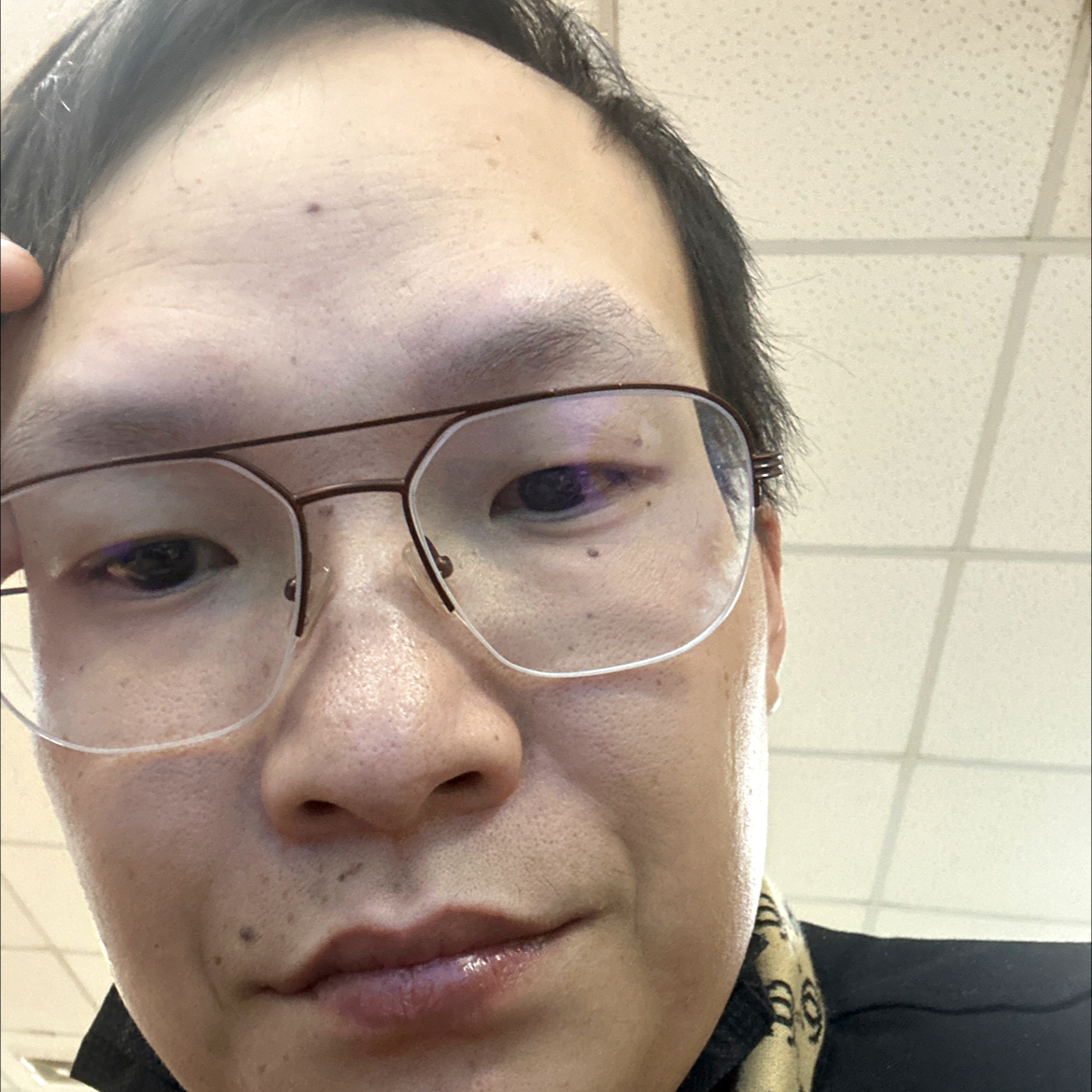 火龙果打怪兽的照片