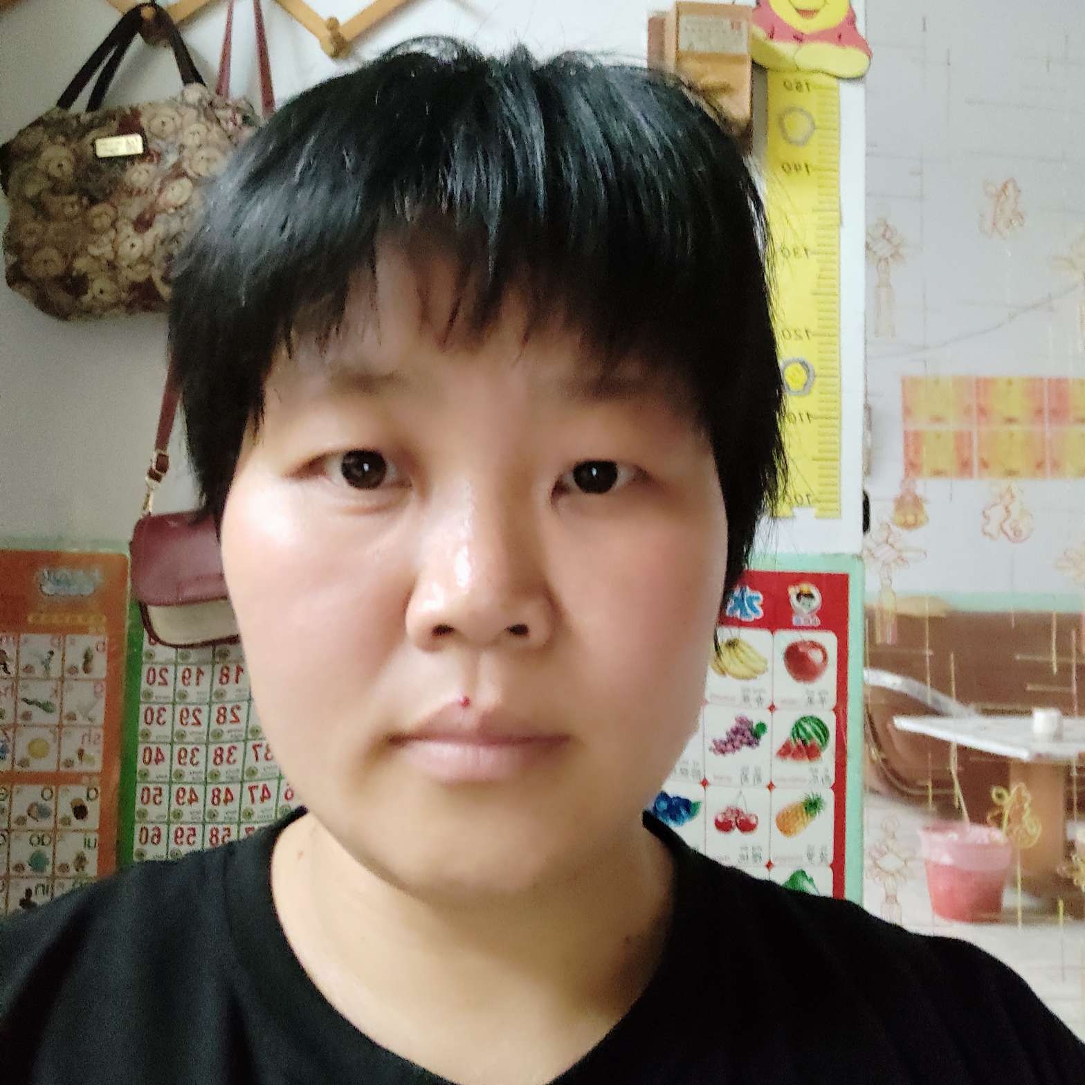 皮气不好的照片