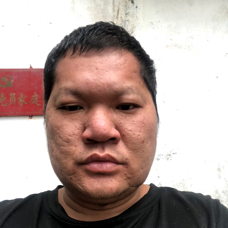 我行缺钱的照片