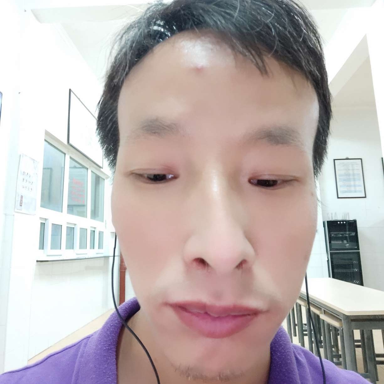 刺猬浅吻无限的照片